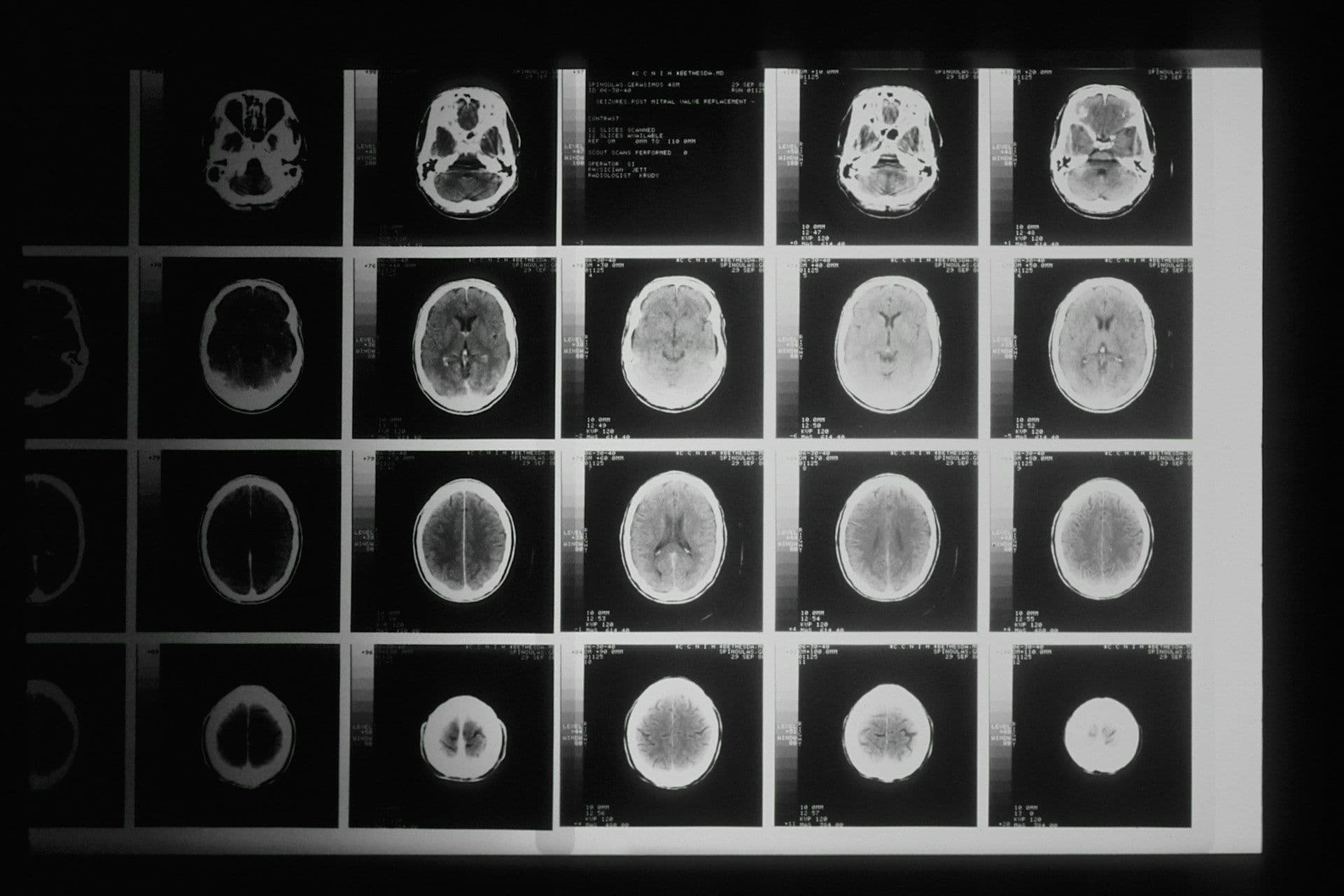 Image for Brain Injury Lawyer in Phoenix