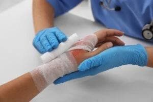 Image for Burn Injury Lawyer in Scottsdale